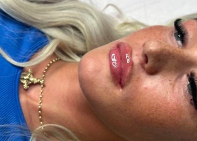 Close-up of lip enhancement at Beauty & Aesthetics By Lil in Bradford, England, GB.