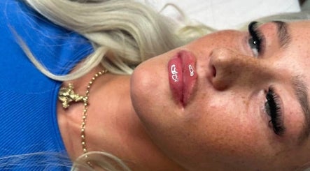 Close-up of lip enhancement at Beauty & Aesthetics By Lil in Bradford, England, GB.