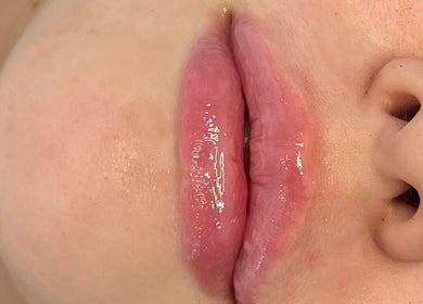 Close-up of glossy lips, a beauty enhancement at Beauty & Aesthetics By Lil, Bradford, England, GB.