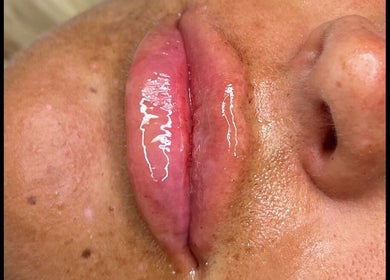Close-up of glossy lips treatment at Beauty & Aesthetics By Lil, Bradford, England, GB.