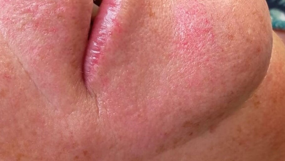 Close-up de pele facial saudável após tratamento no LuminaSpa, Aveiro, Aveiro, PT.