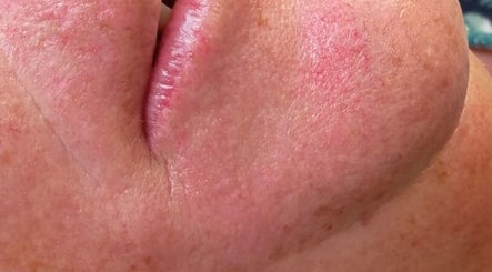 Close-up de pele facial saudável após tratamento no LuminaSpa, Aveiro, Aveiro, PT.