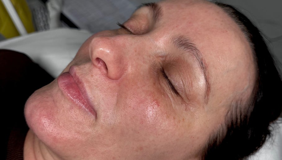 Ameral Skin image 1