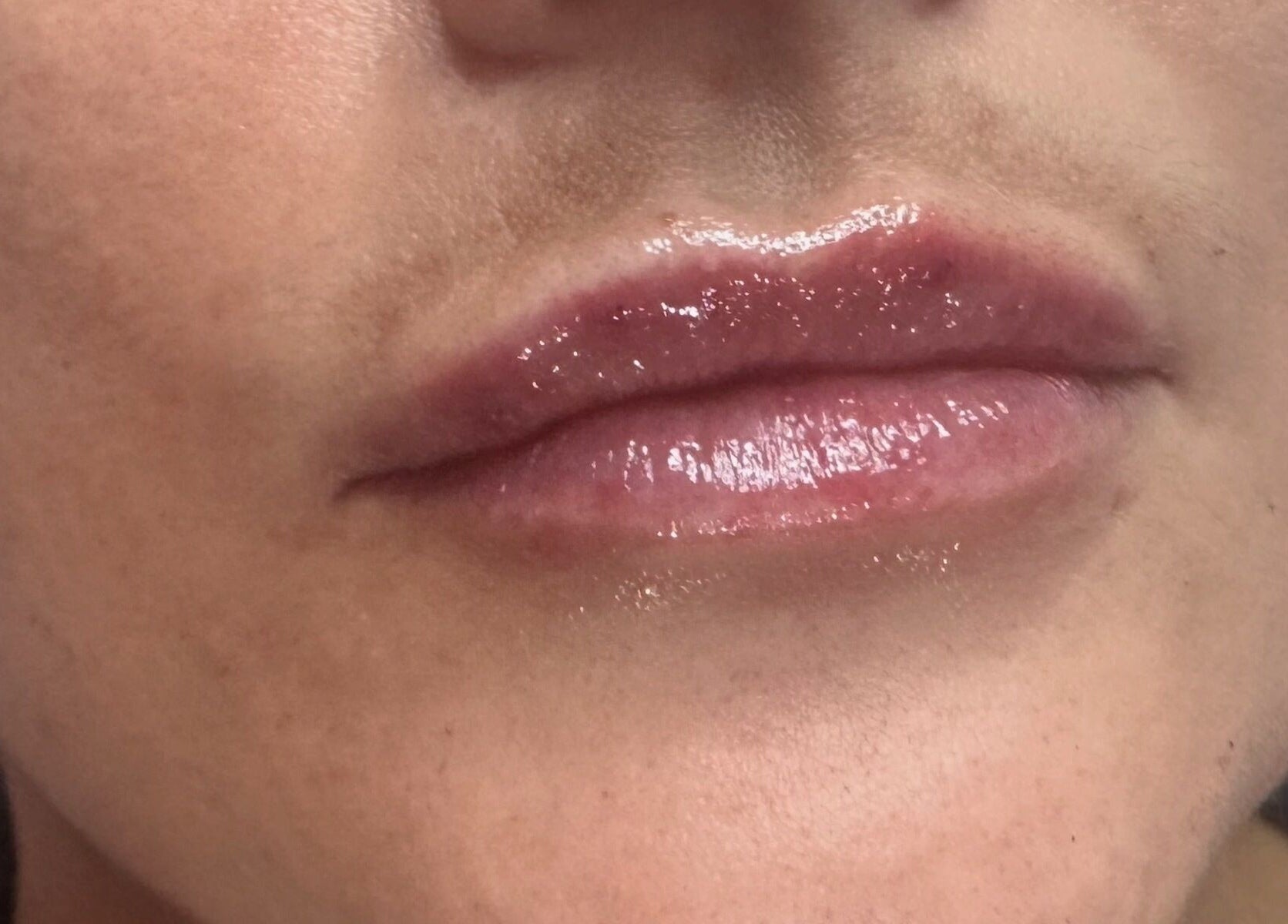 Glossy lips treatment at Pixie Glow Aesthetics & Nails, Harlow, England, GB enhances natural beauty.