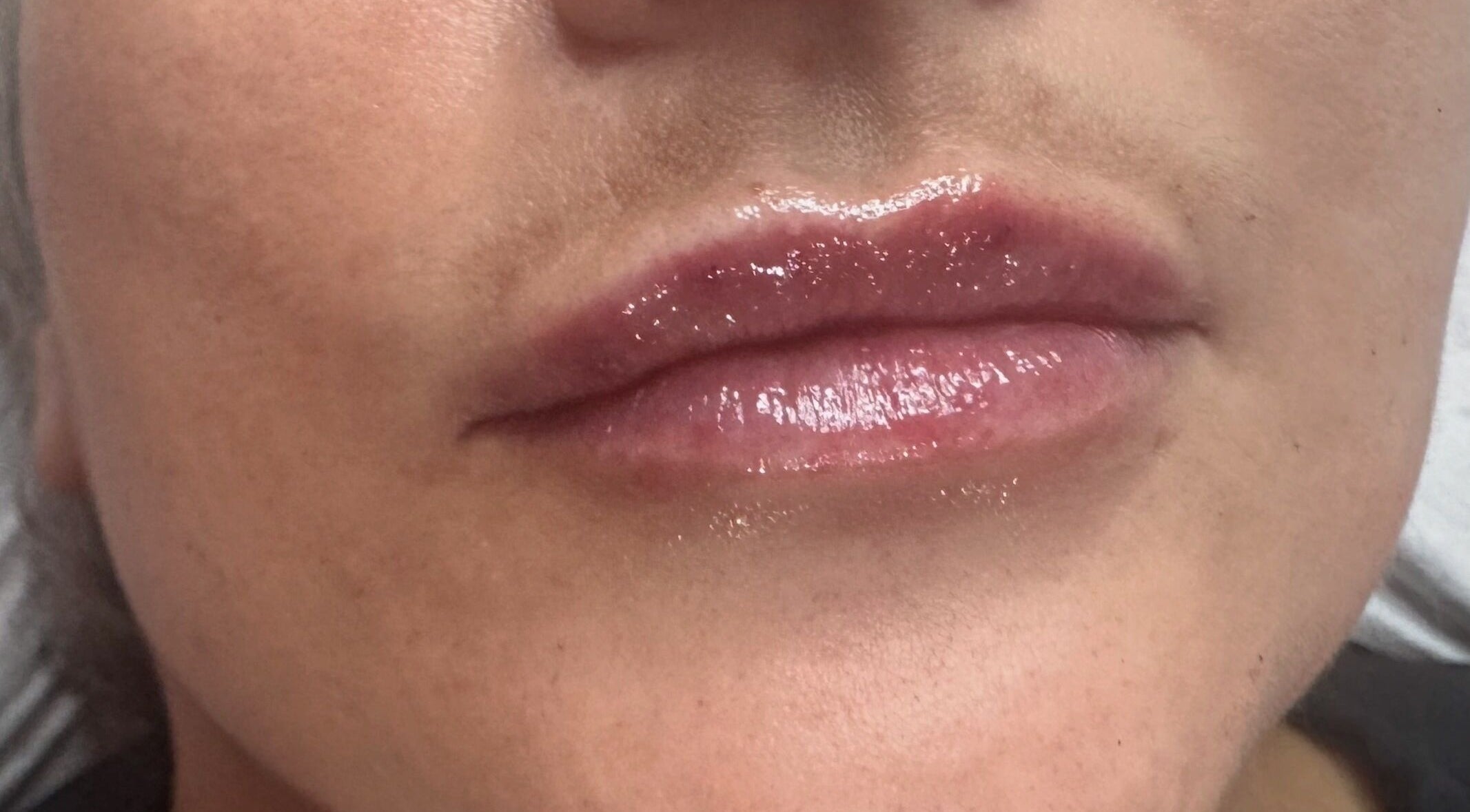 Glossy lips treatment at Pixie Glow Aesthetics & Nails, Harlow, England, GB enhances natural beauty.