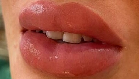 Bobo Aesthetics Clinic image 1
