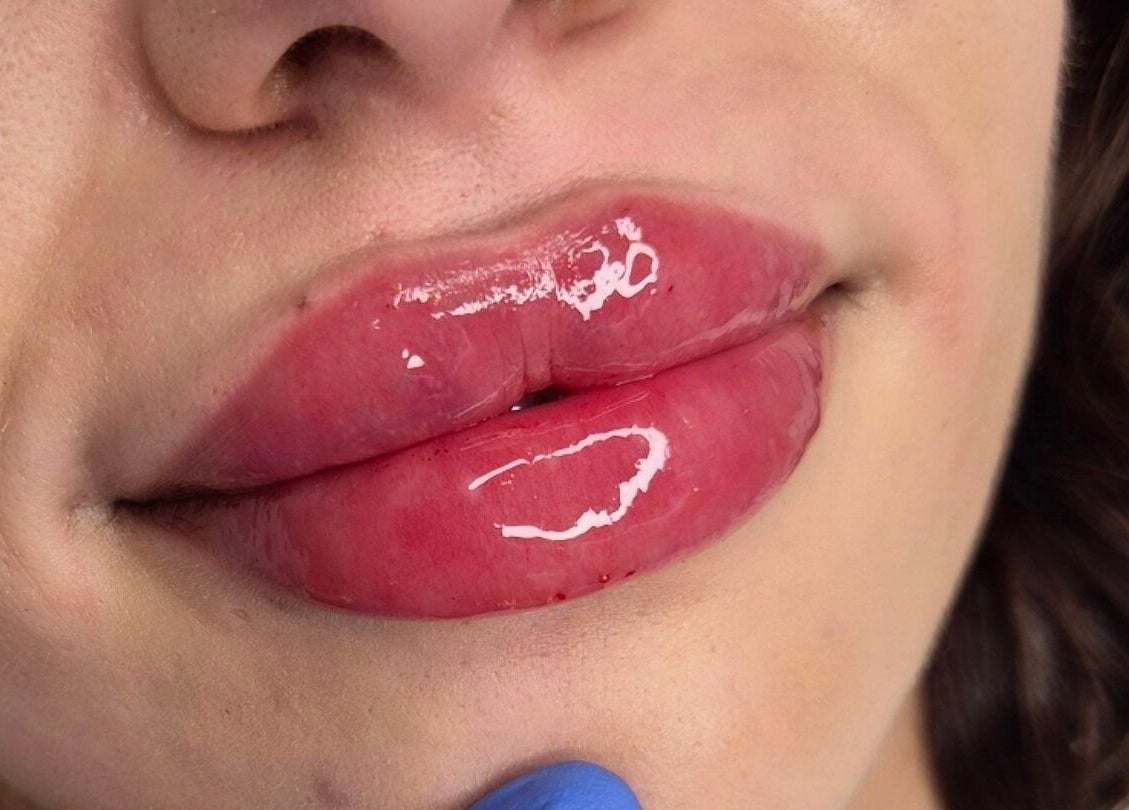 Close-up of glossy lips after treatment at Gemini Aesthetic, Royal Tunbridge Wells, England, GB.