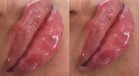 Navaderm Aesthetic Clinic image 2