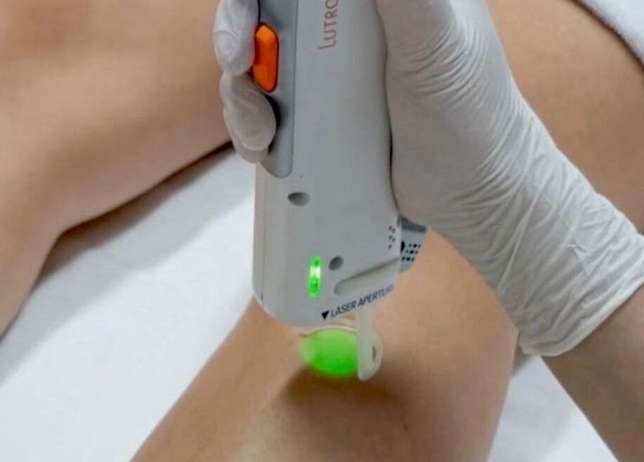 Laser hair removal in progress at Miss Marie’s, Brooklyn, Nova Scotia, CA, enhancing smoothness and beauty.
