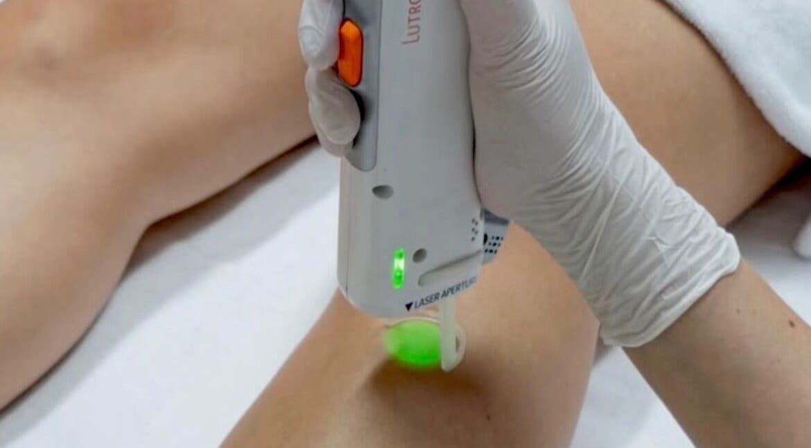 Laser hair removal in progress at Miss Marie’s, Brooklyn, Nova Scotia, CA, enhancing smoothness and beauty.