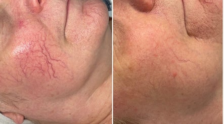 Image de Clinique DermaSkin 3