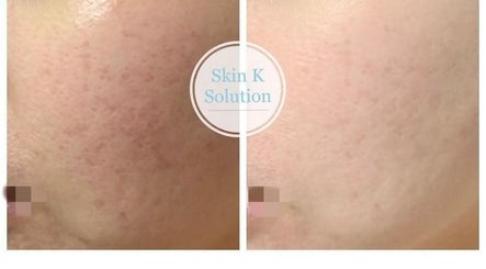SKIN K Solution Beauty