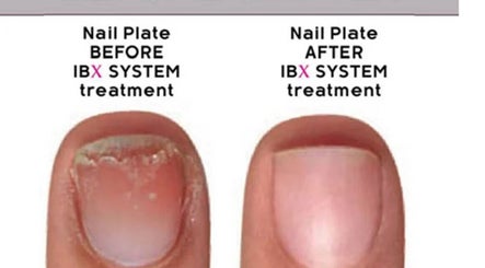 Before and after IBX System treatment at Aspire Nail Care Studio in Greenwood Village, Colorado, US.