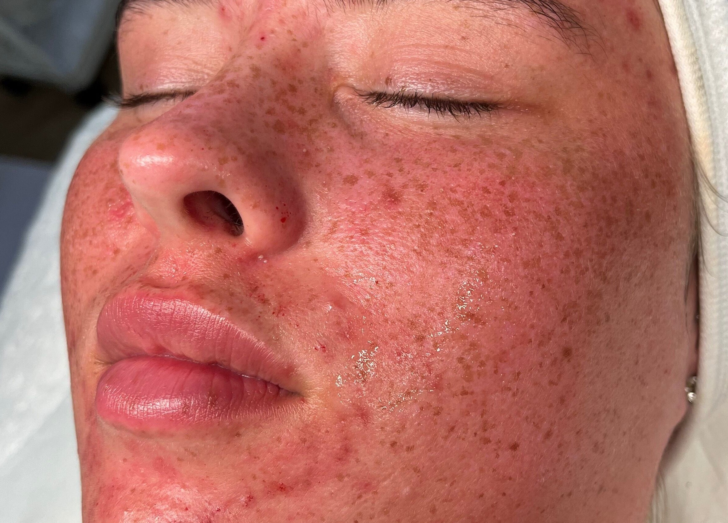 Close-up of a rejuvenating facial treatment at Skin Luxe Studio, Fleur-de-lis, Wales, GB.