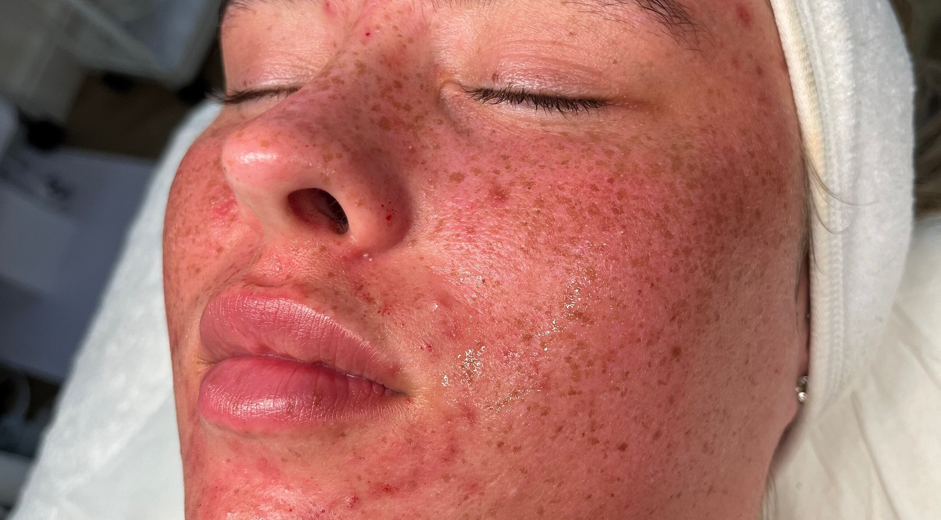 Close-up of a rejuvenating facial treatment at Skin Luxe Studio, Fleur-de-lis, Wales, GB.