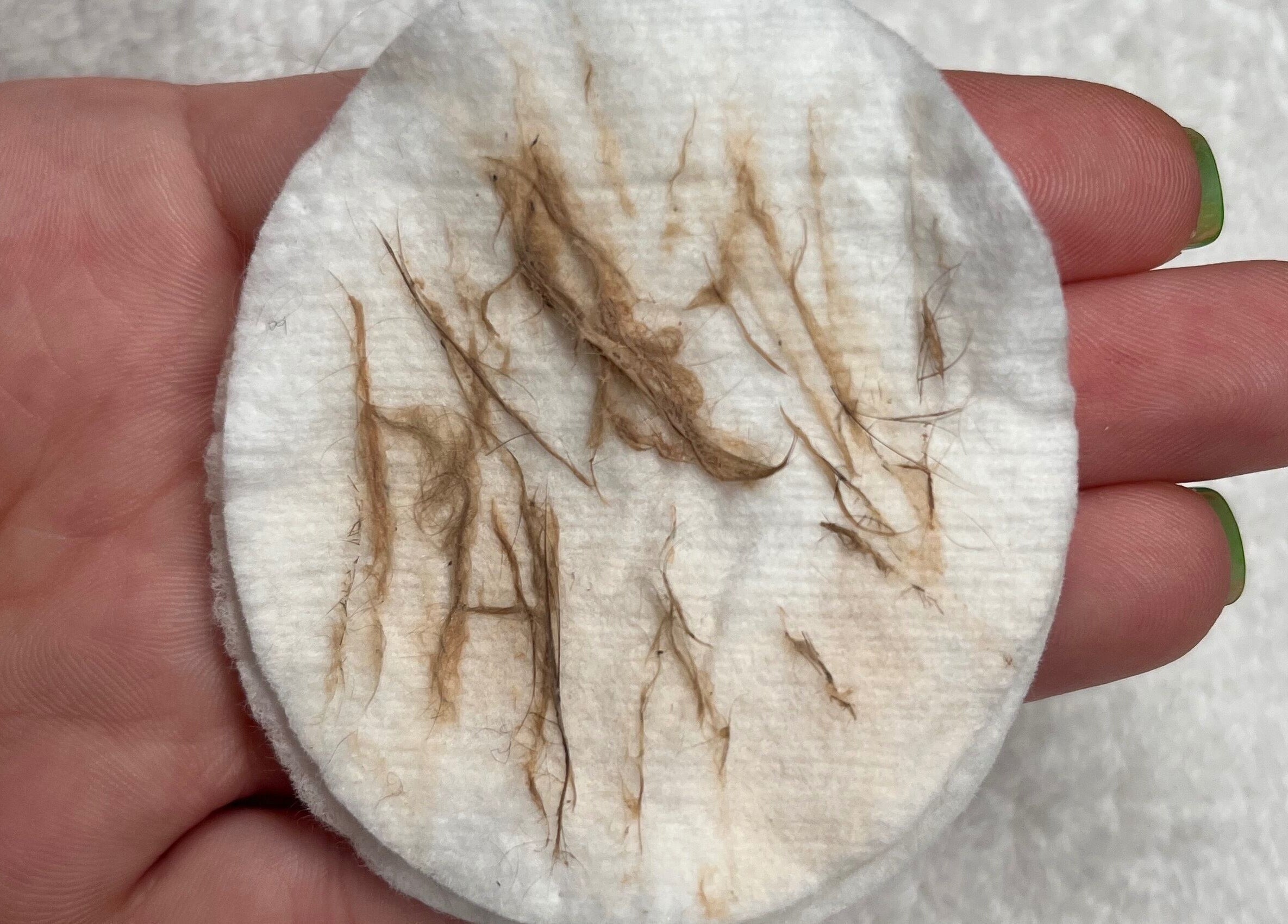 Used cotton pad post-treatment at Skin Luxe Studio, Fleur-de-lis, Wales, GB, highlighting cleansing results.