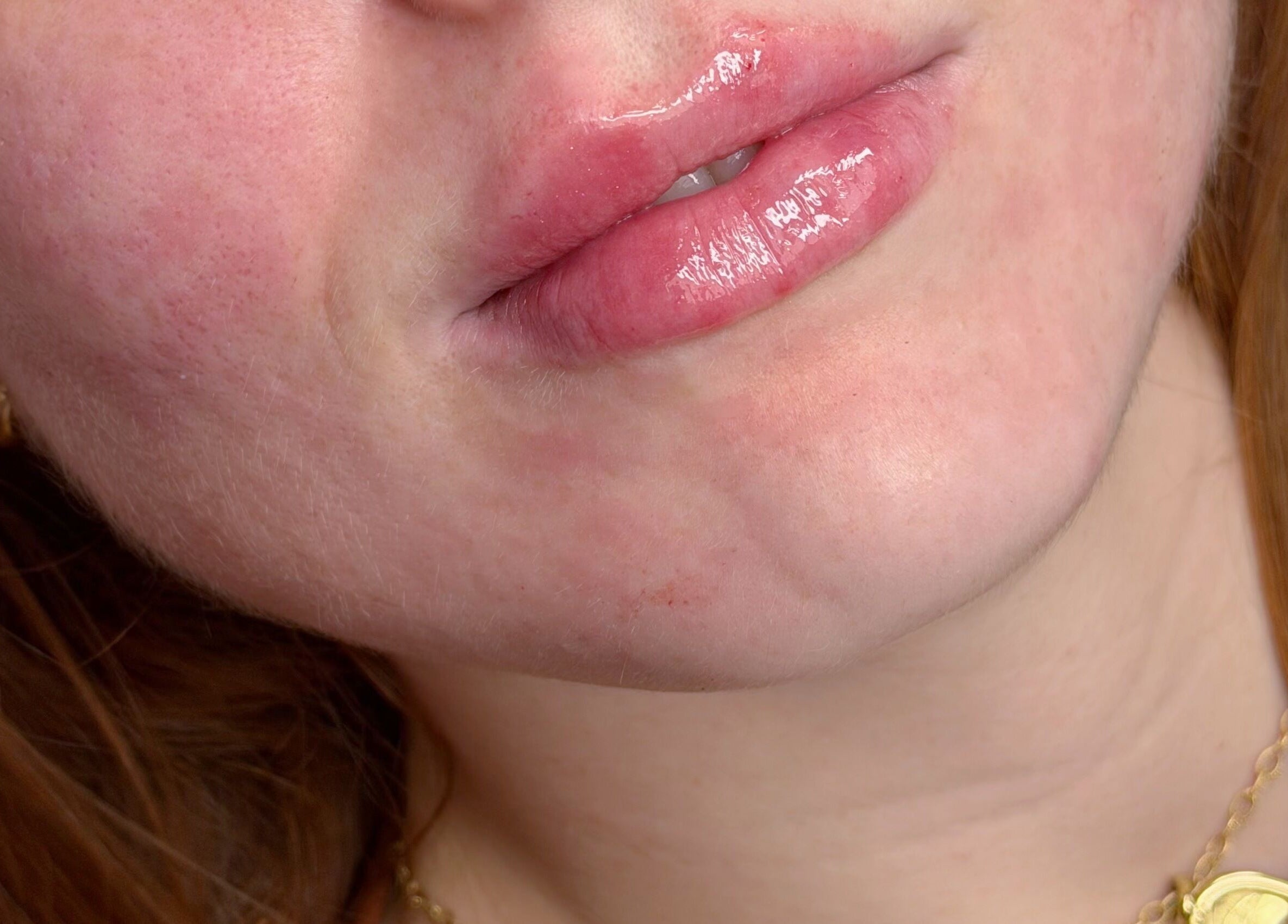 Close-up of glossy lips at Sue Aesthetic, Whitburn, England, GB, showcasing natural skin.
