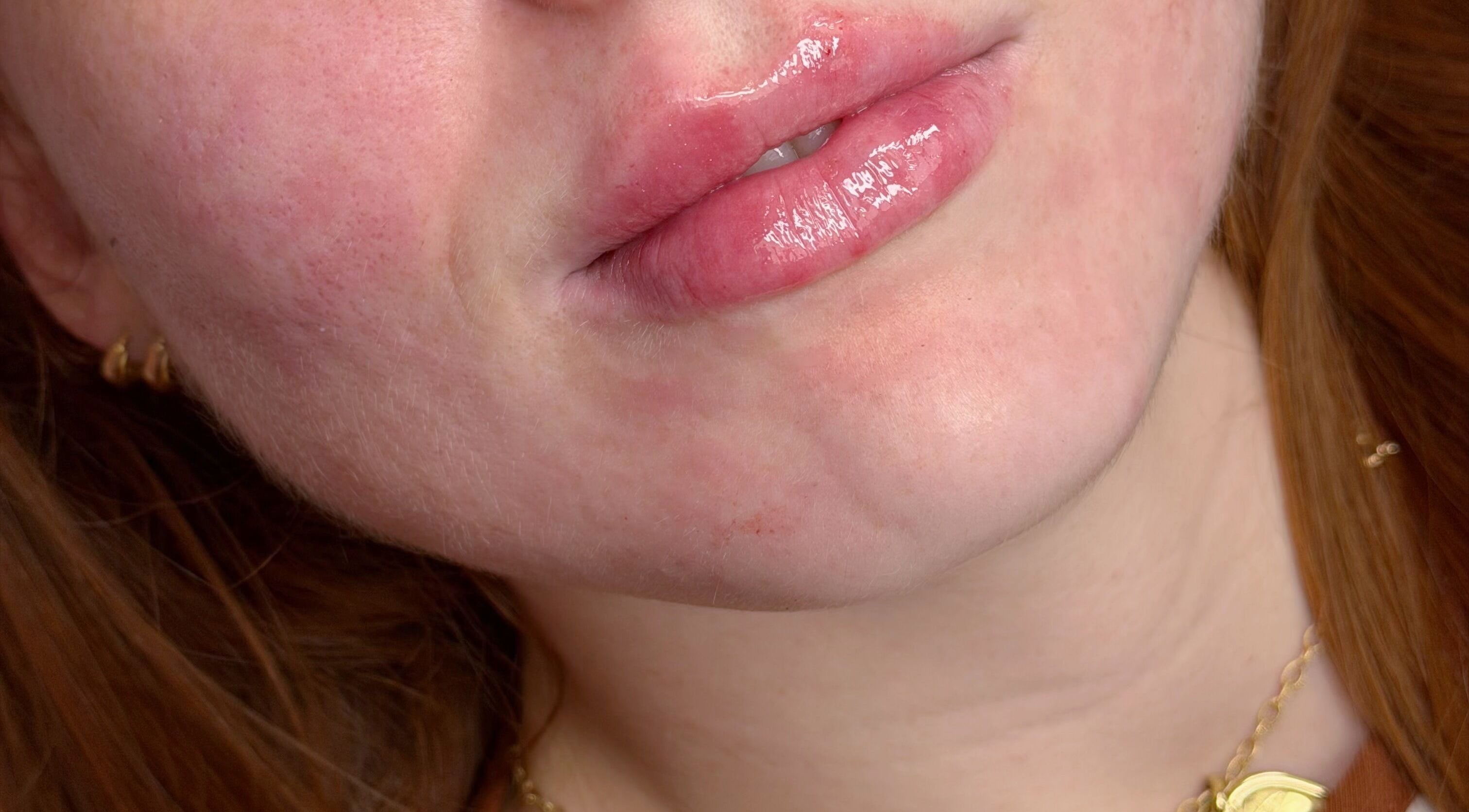 Close-up of glossy lips at Sue Aesthetic, Whitburn, England, GB, showcasing natural skin.