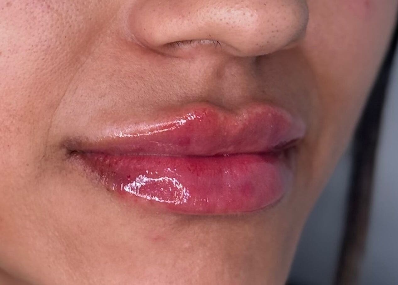 Close-up of glossy enhanced lips at Sue Aesthetic, Whitburn, England, GB, showcasing expert lip treatment.