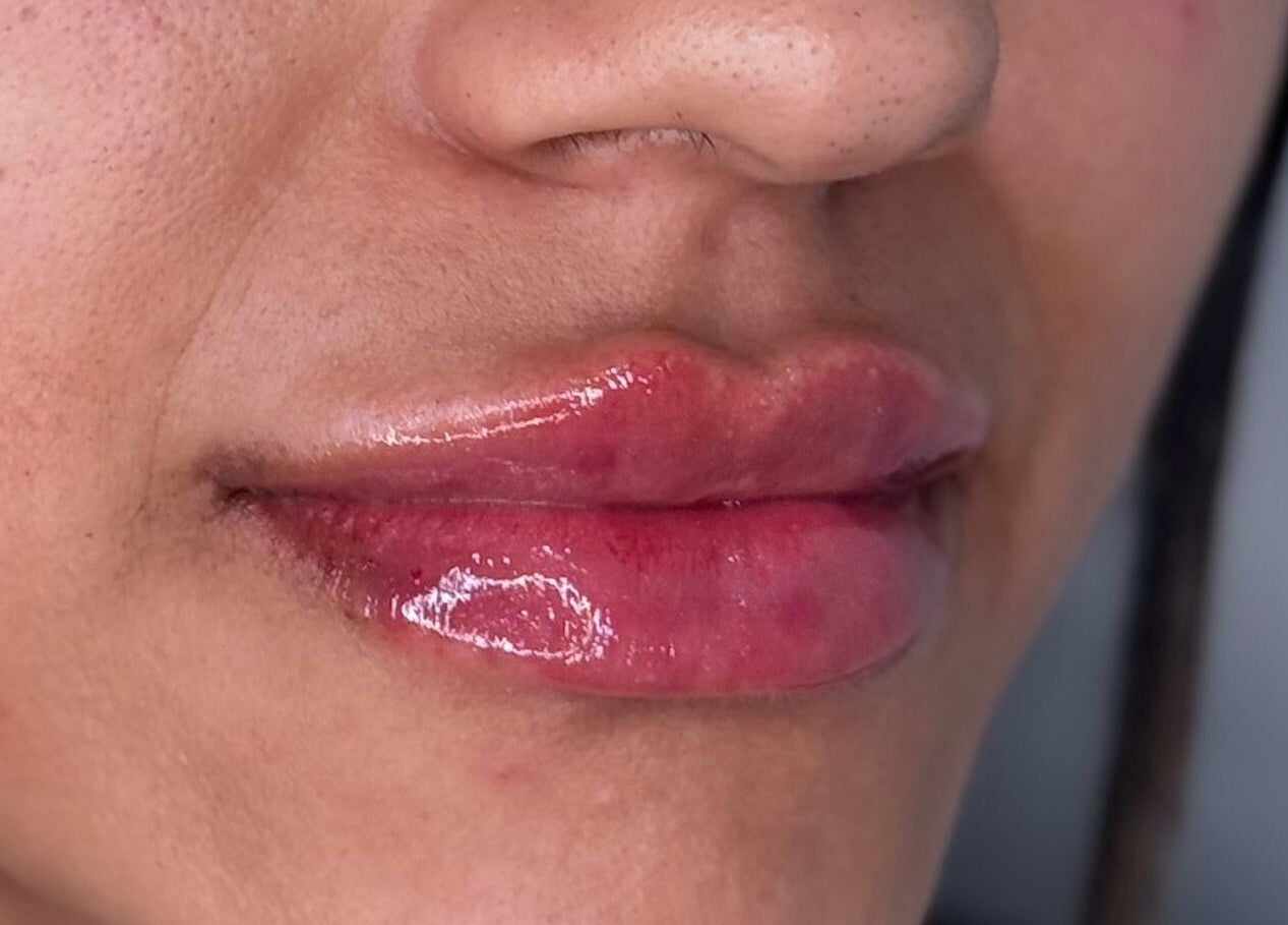 Close-up of glossy enhanced lips at Sue Aesthetic, Whitburn, England, GB, showcasing expert lip treatment.