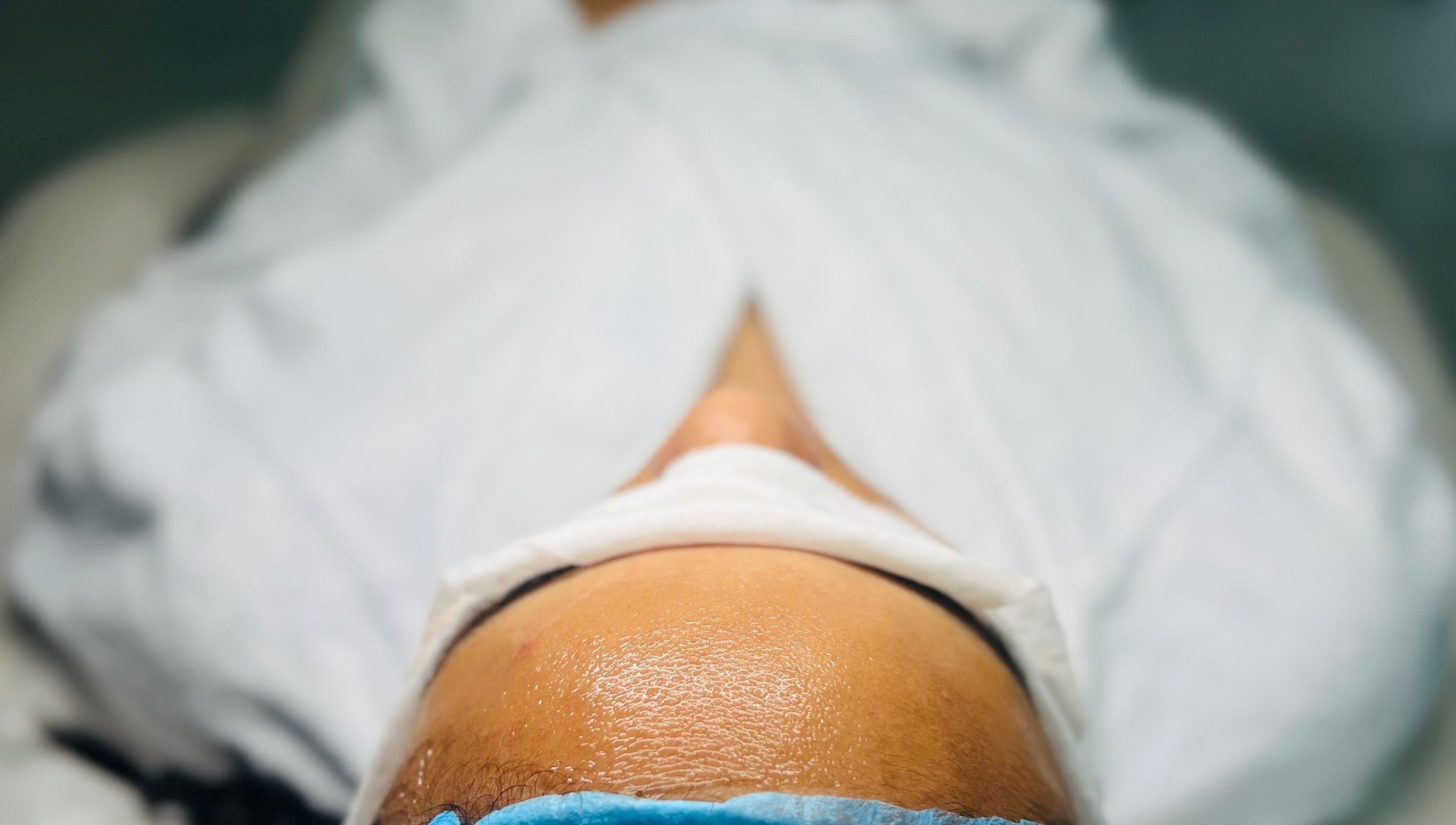 Tratamiento facial en Cicuta Estetic Spa, Santiago De Los Caballeros, Santiago, DO.