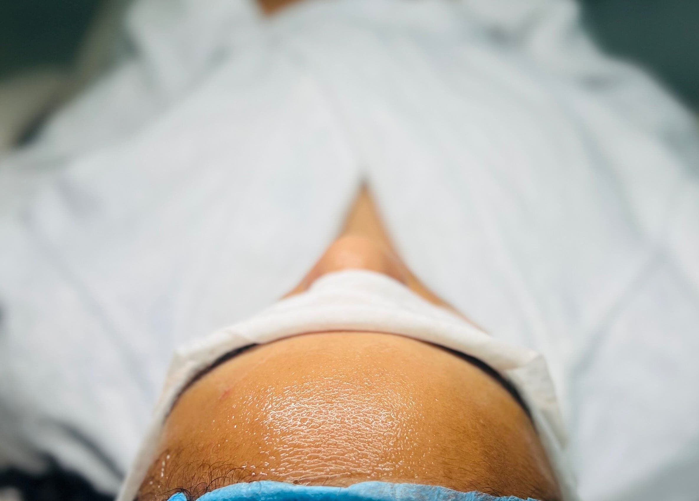 Tratamiento facial en Cicuta Estetic Spa, Santiago De Los Caballeros, Santiago, DO.