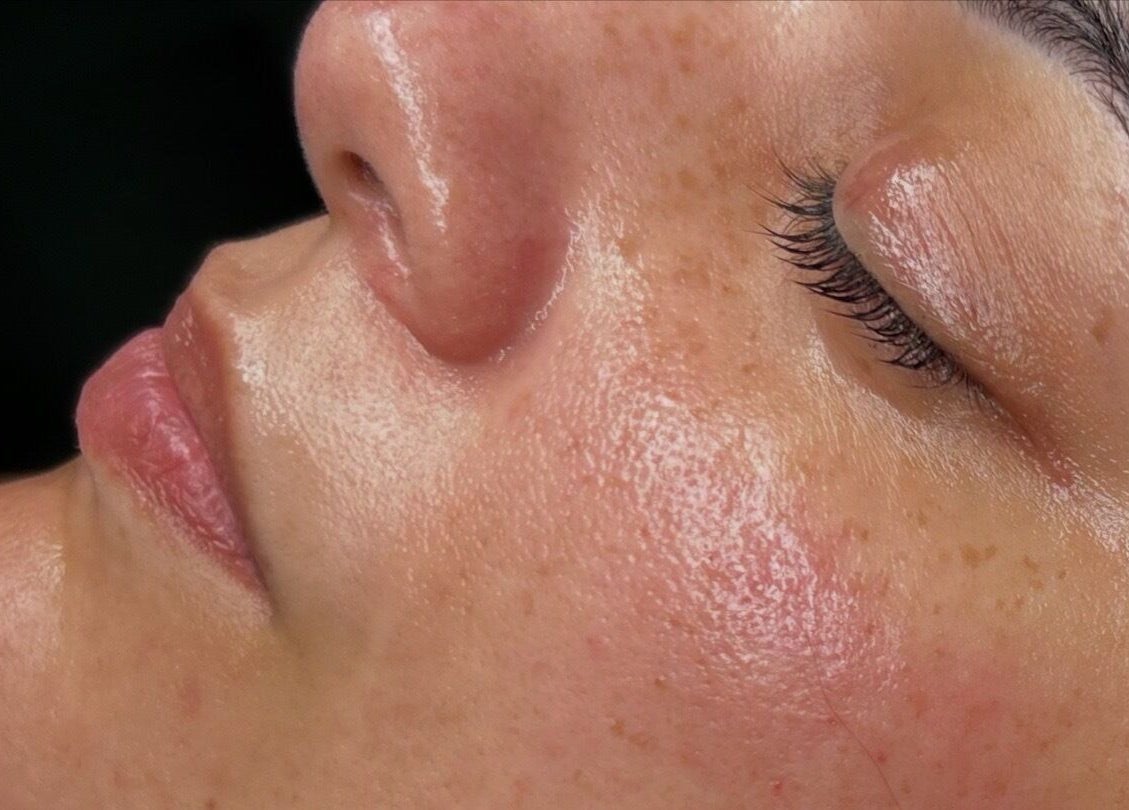 Tratamiento facial en Cicuta Estetic Spa en Santiago De Los Caballeros, Santiago, DO.