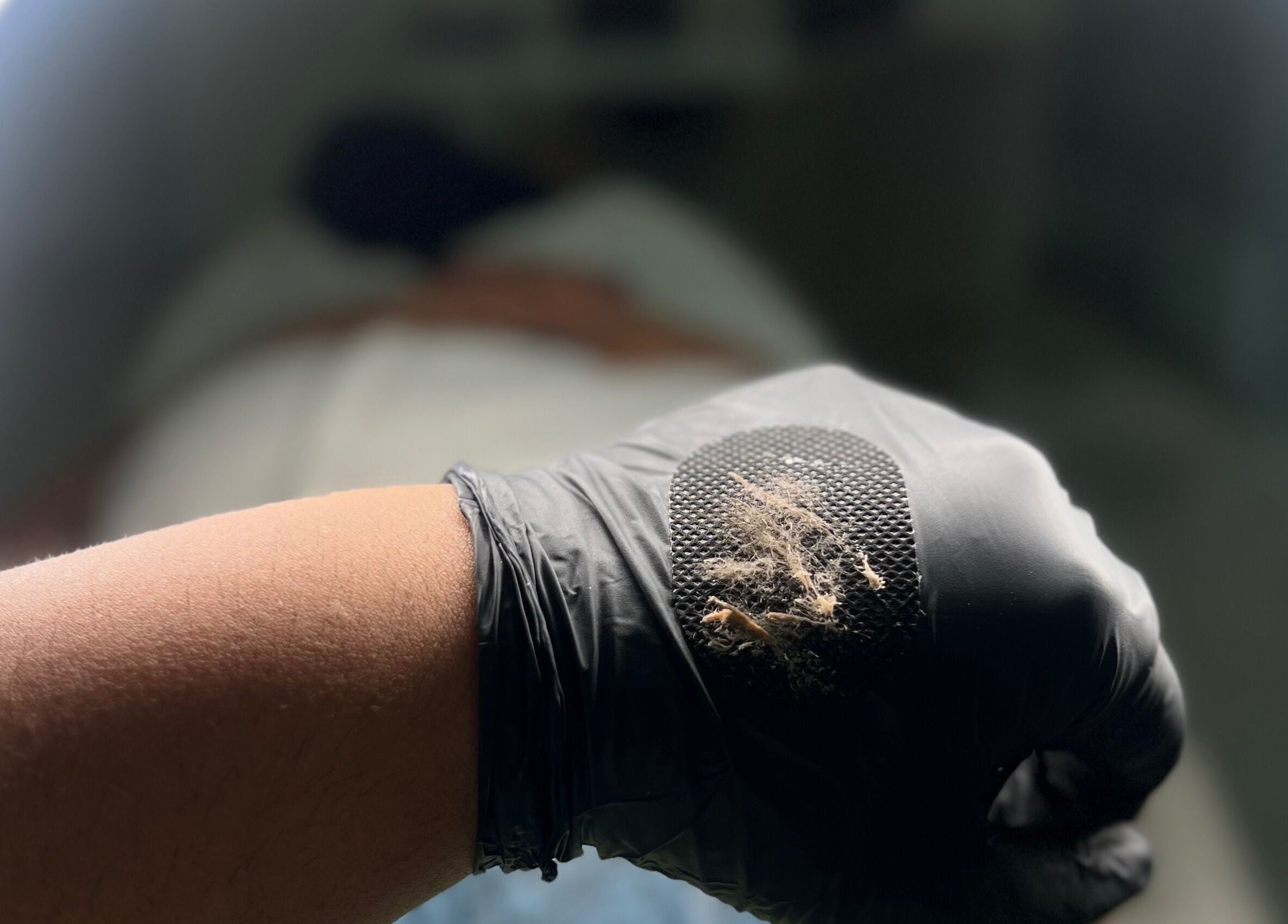 Tratamiento de exfoliación en Cicuta Estetic Spa, Santiago De Los Caballeros, Santiago, DO.