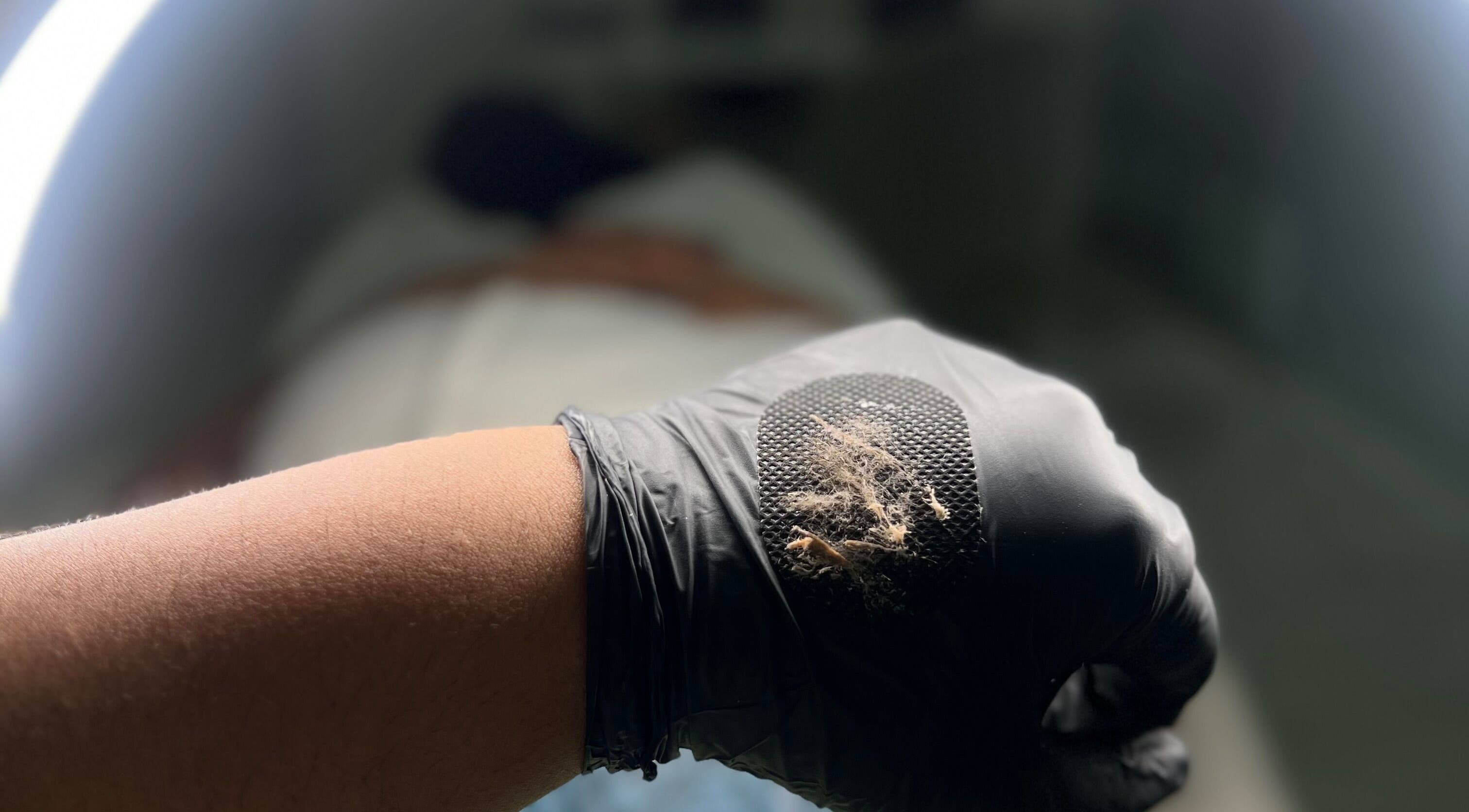 Tratamiento de exfoliación en Cicuta Estetic Spa, Santiago De Los Caballeros, Santiago, DO.