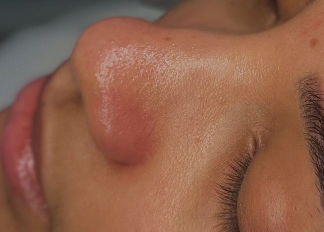 Rostro exfoliado en Cicuta Estetic Spa, Santiago De Los Caballeros, Santiago, DO.