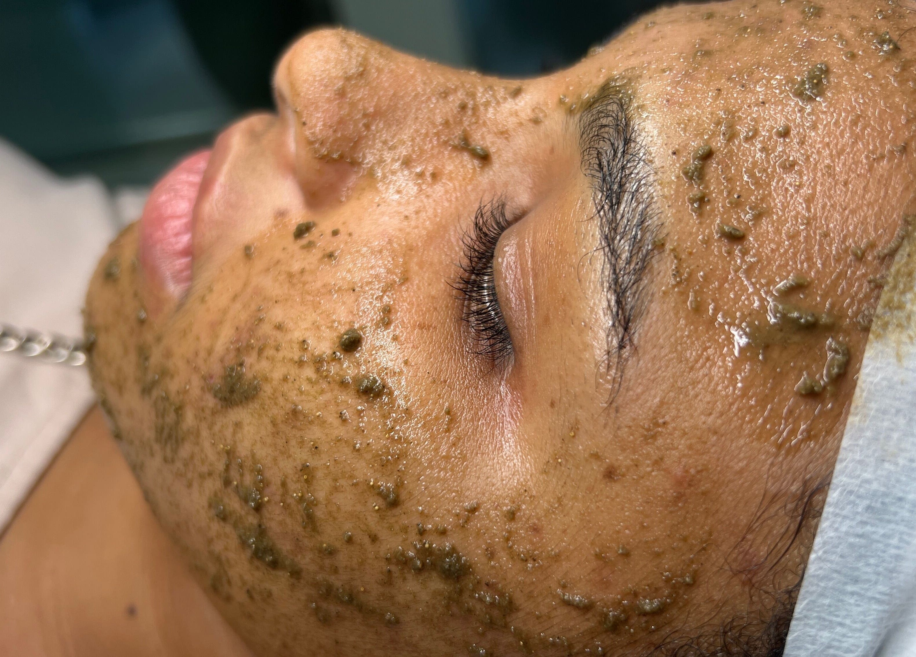 Tratamiento facial rejuvenecedor en Cicuta Estetic Spa, Santiago De Los Caballeros, Santiago, DO.