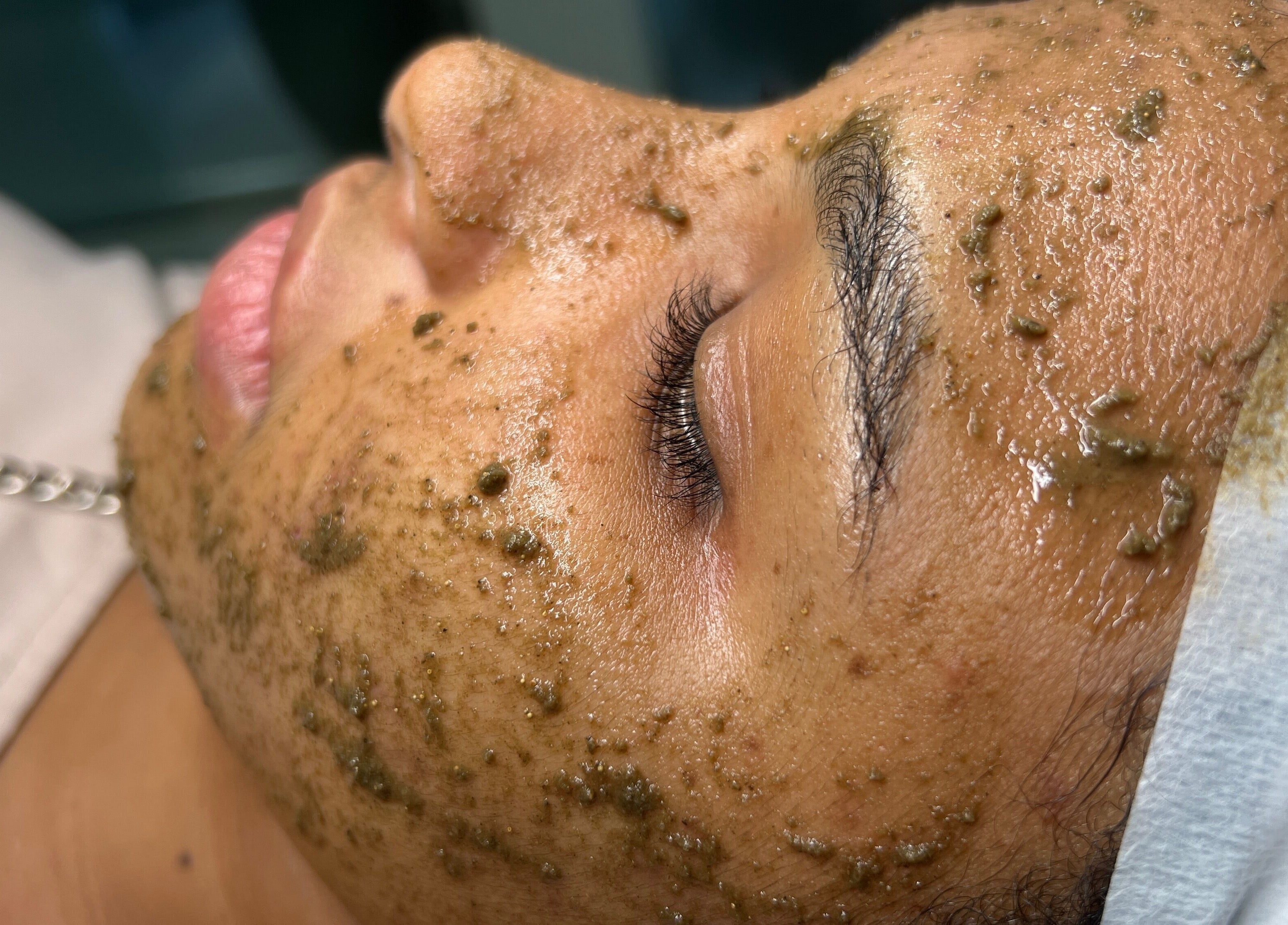 Tratamiento facial rejuvenecedor en Cicuta Estetic Spa, Santiago De Los Caballeros, Santiago, DO.