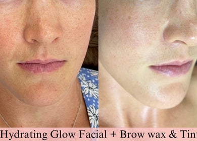 Close-up of glowing skin after facial at Beauty By Kelly, Boyne Island, Queensland, AU.