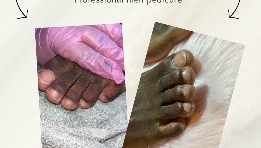Voor en na professionele pedicure bij Jv’s LuxuryNails, Amsterdam, Noord-Holland, NL.