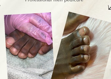Voor en na professionele pedicure bij Jv’s LuxuryNails, Amsterdam, Noord-Holland, NL.