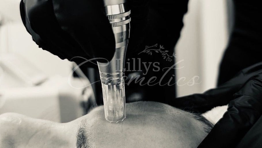 Facial treatment at @Lillys.Cosmeticsx, Home Studio 🎀 in Maidstone, England, GB. Enhancing skin rejuvenation.