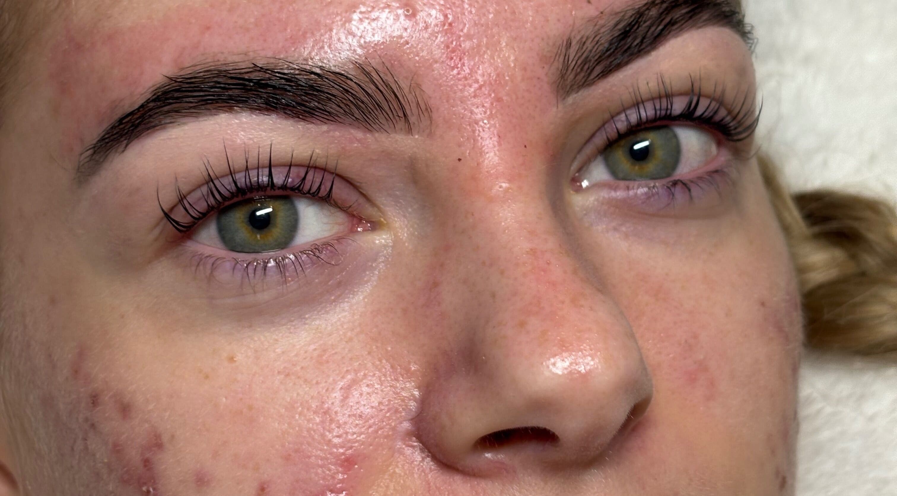 Close-up of refreshed skin at The Glow Up Club, Brough, England, GB, highlighting natural beauty recovery.