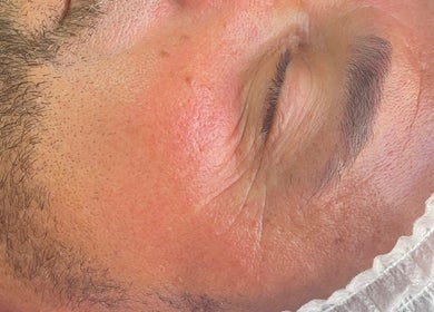 Tratamento facial na AC Saúde & Beleza em Seixal, Setúbal, PT.
