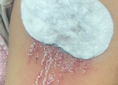 Tratamento de pele em AC Saúde & Beleza, Seixal, Setúbal, PT, focado em hidratação e reparação da epiderme.