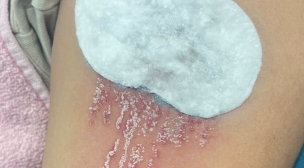 Tratamento de pele em AC Saúde & Beleza, Seixal, Setúbal, PT, focado em hidratação e reparação da epiderme.