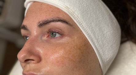 Close-up of facial treatment at KM Skin in Clydebank, Scotland, GB highlighting smooth, glowing skin