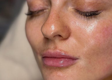 Close-up of smooth, glowing skin after treatment at KM Skin, Clydebank, Scotland, GB.