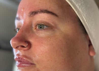 Close-up of a person's smooth skin after treatment at KM Skin, Clydebank, Scotland, GB.