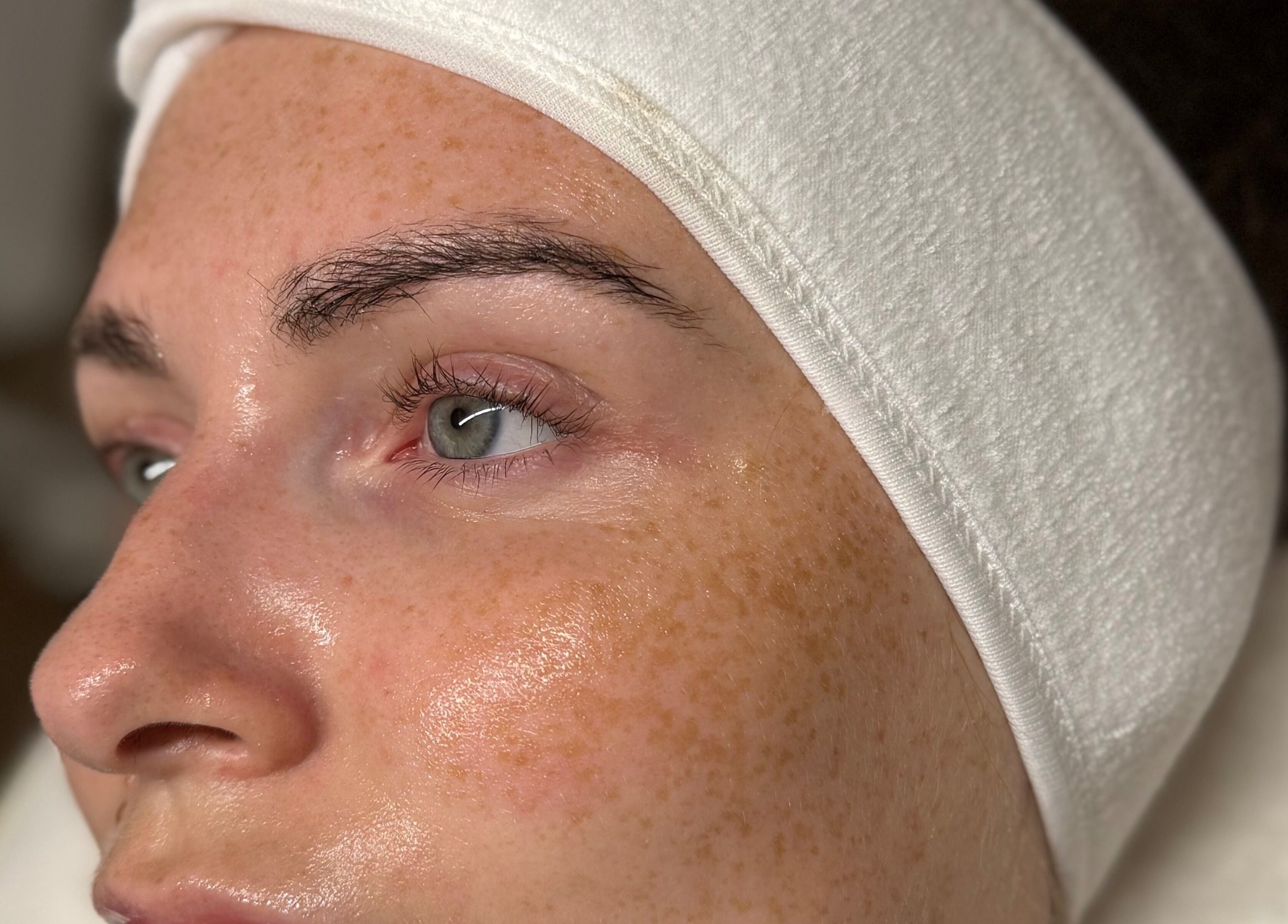 Close-up of a woman's radiant skin during a facial at KM Skin, Clydebank, Scotland, GB.