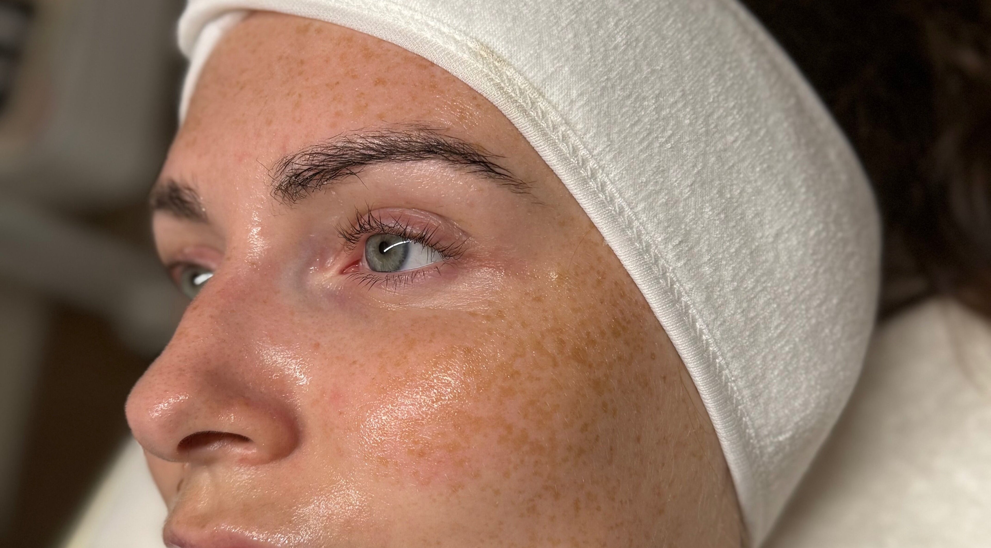 Close-up of a woman's radiant skin during a facial at KM Skin, Clydebank, Scotland, GB.
