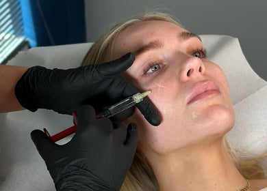 Facial injection treatment at Mediatrix Clinic, Qormi, MT for skin rejuvenation.
