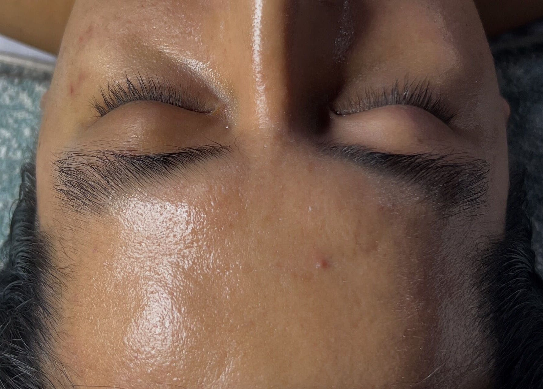 Tratamiento facial en Cosmiatra Ariana Ruilova, Samborondón, Guayas, EC, mostrando piel limpia y cuidada.