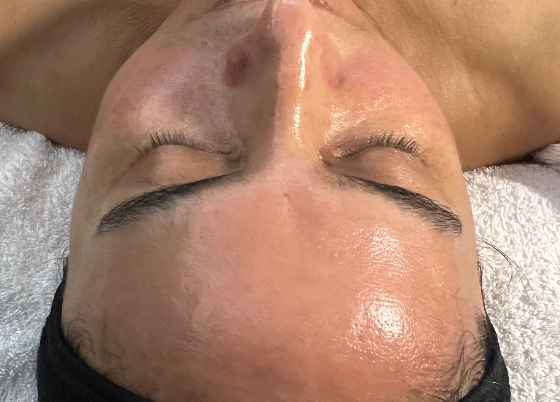Tratamiento facial relajante en Cosmiatra Ariana Ruilova, Samborondón, Guayas, EC para piel radiante.