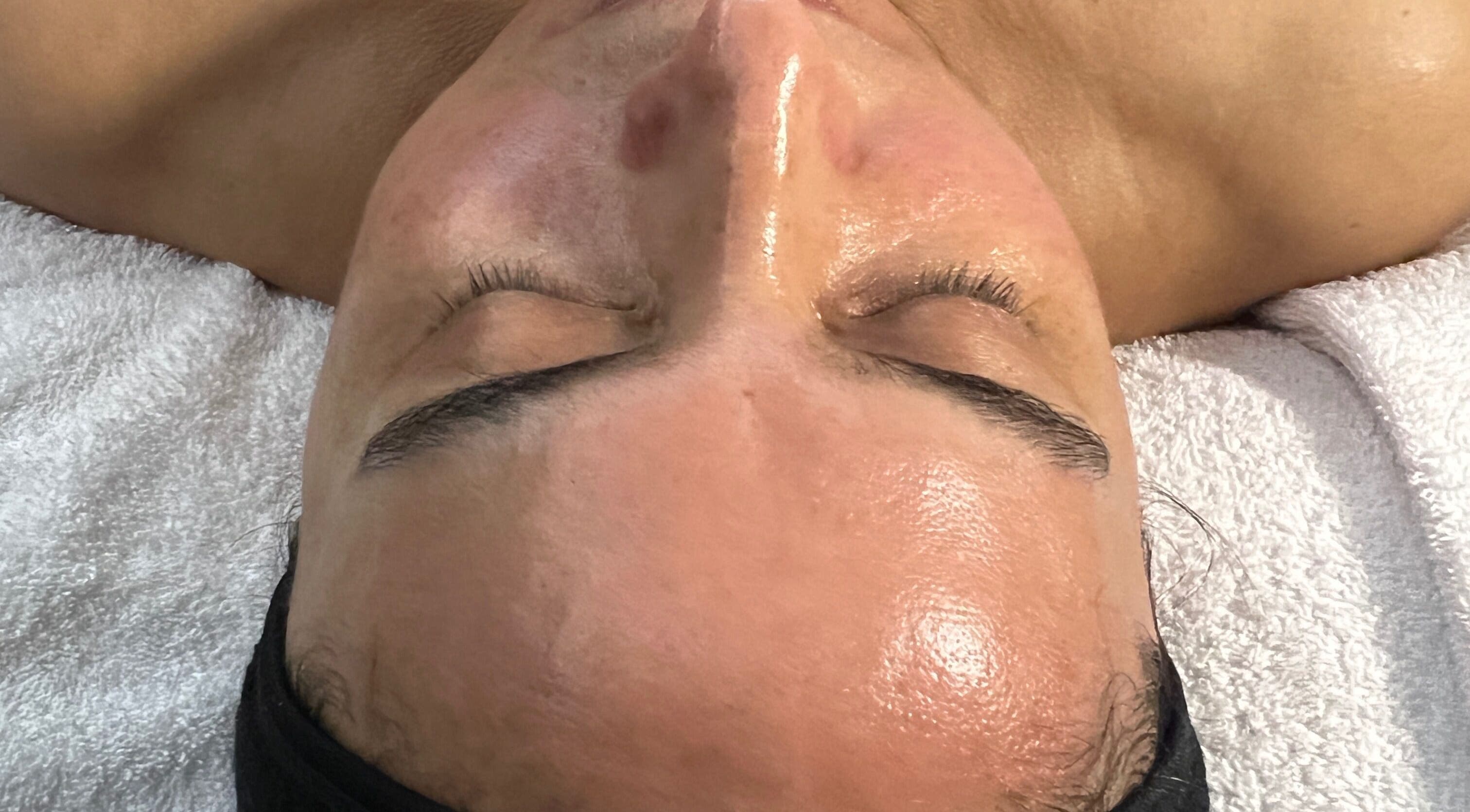 Tratamiento facial relajante en Cosmiatra Ariana Ruilova, Samborondón, Guayas, EC para piel radiante.