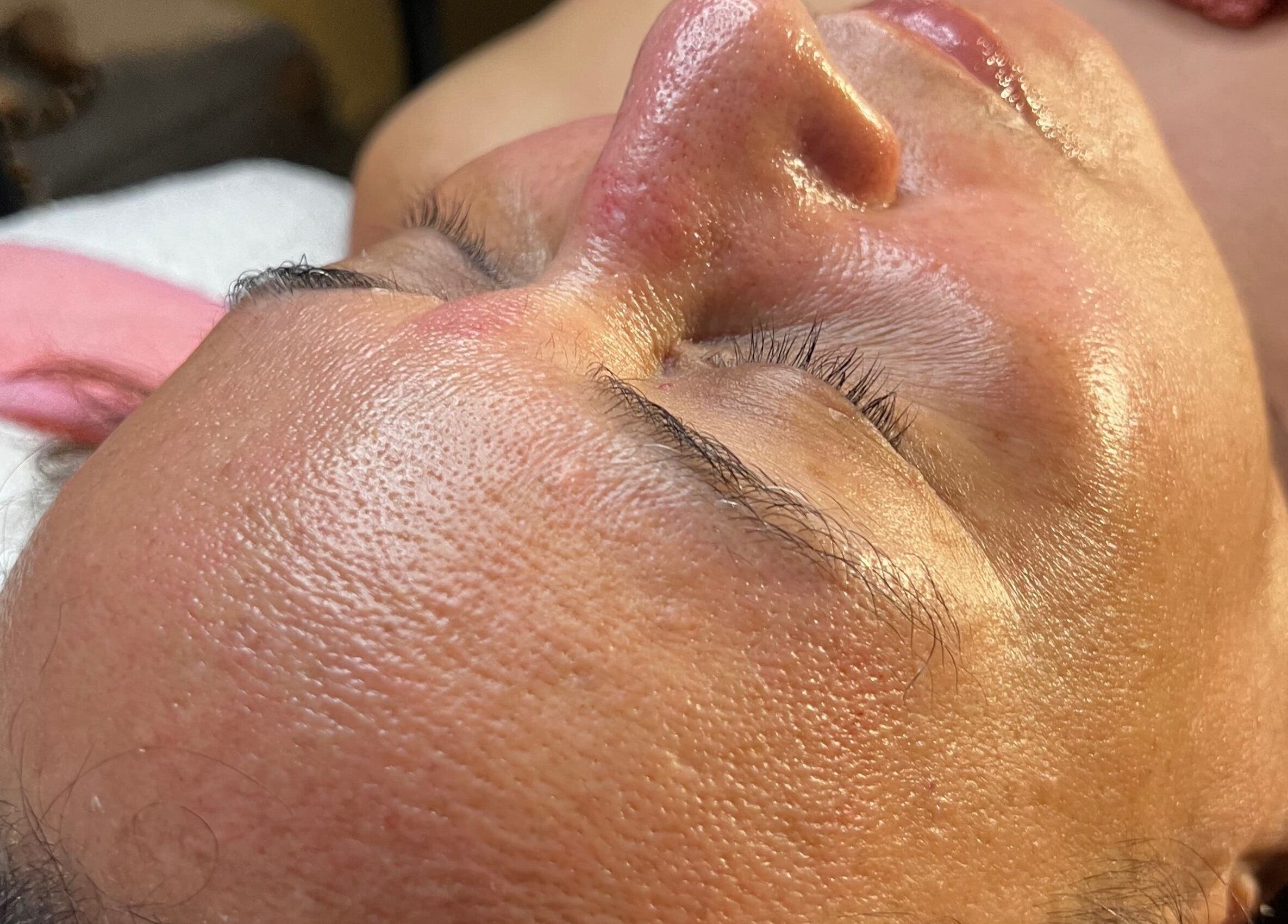 Tratamiento facial en Cosmiatra Ariana Ruilova, Samborondón, Guayas, EC. Resalta suavidad de la piel.